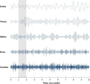 EFt klopfen verändert die frequenzen der gehirnwellen